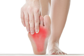 plantar fasciitis