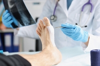 Minimally Invasive Foot Surgery